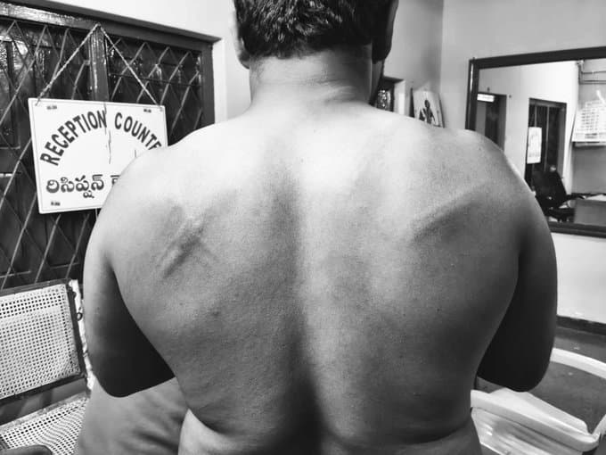 చిలమత్తూరులో విలేఖరిపై దాడి కలకలం – బాలకృష్ణ నియోజకవర్గంలో ఉద్రిక్తత