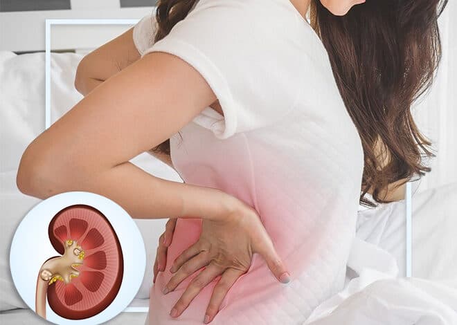 రోజువారీ అలవాట్లే కిడ్నీలో రాళ్లకు కారణమవుతాయా?