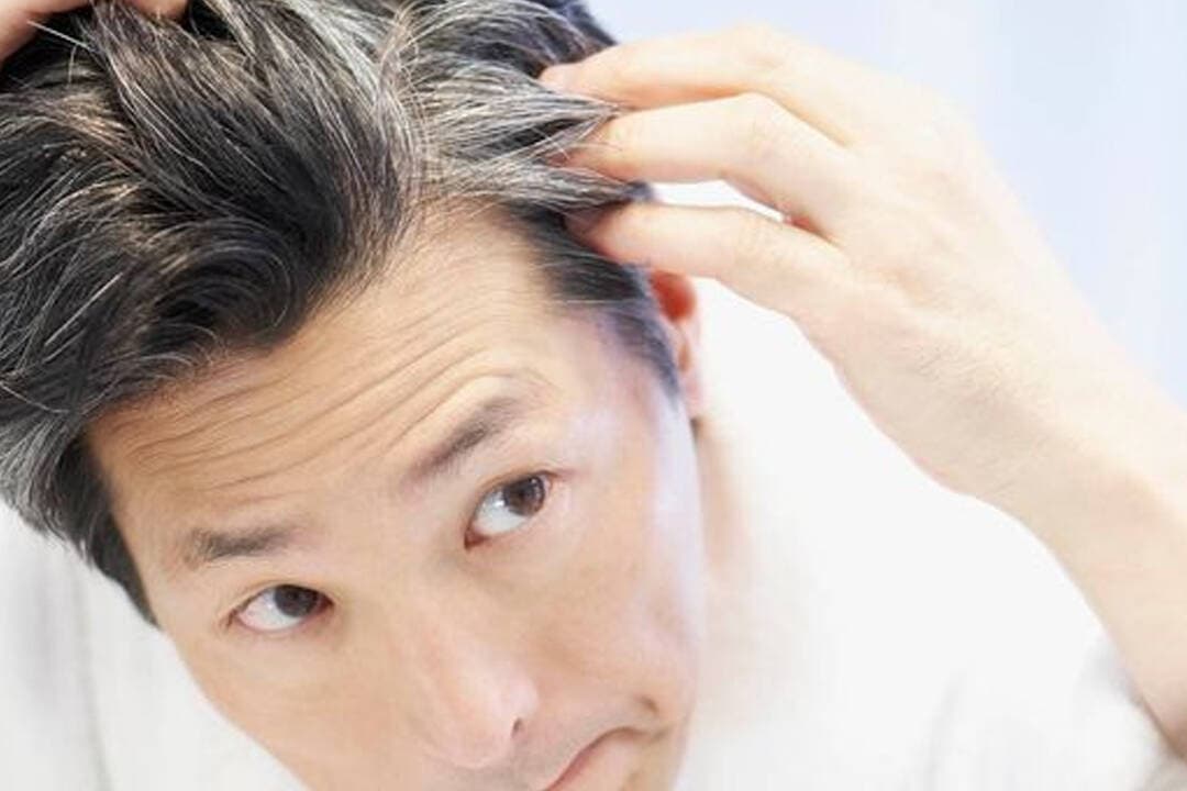 చిన్న వయసులో తెల్లజుట్టుకు కారణం మెలనిన్ తగ్గడం – హెచ్చరిస్తున్న డాక్టర్లు